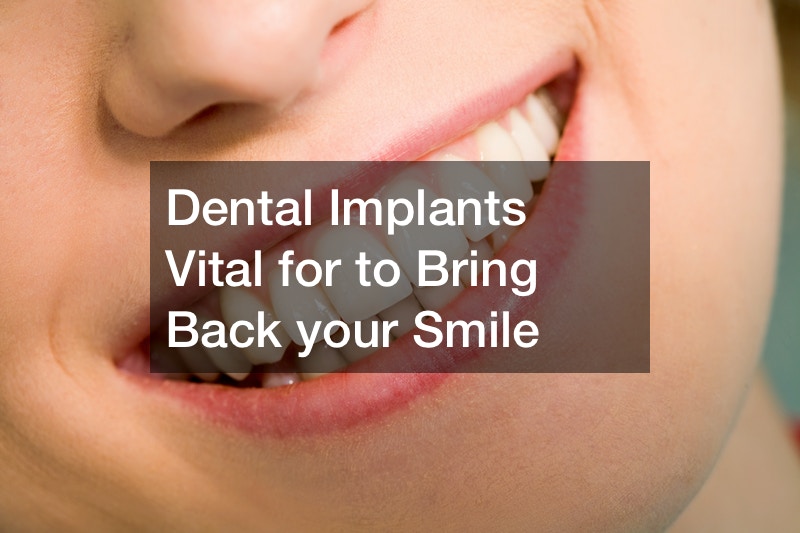 Dental Implants Vital for to Bring Back your Smile