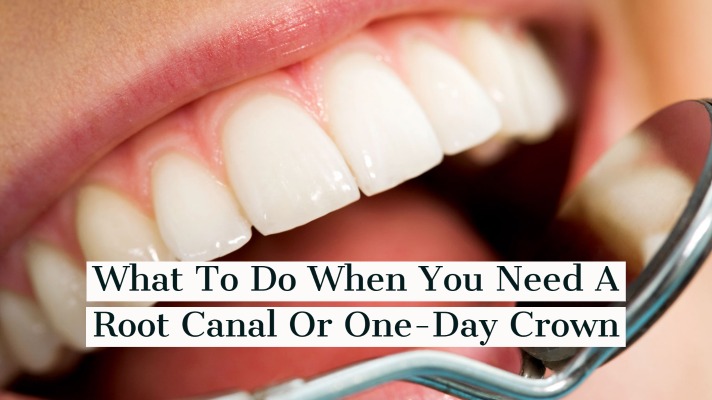 What To Do When You Need A Root Canal Or One-Day Crown