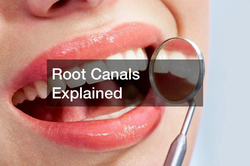 Root Canals Explained
