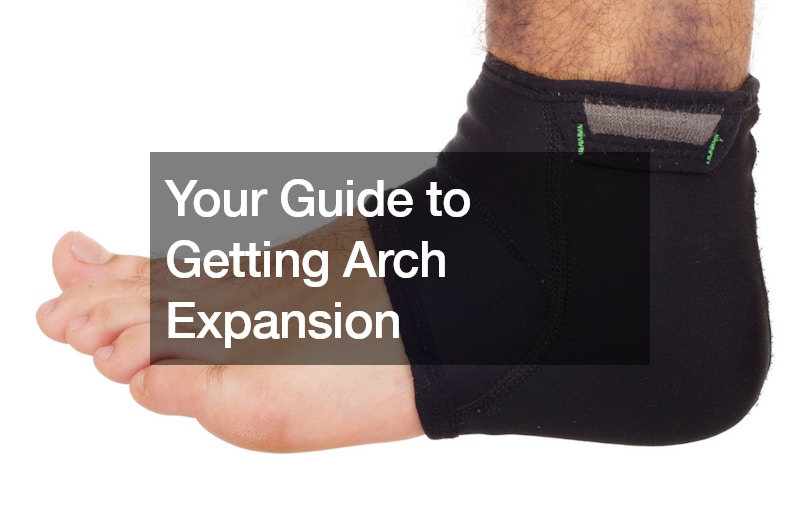 Your Guide to Getting Arch Expansion